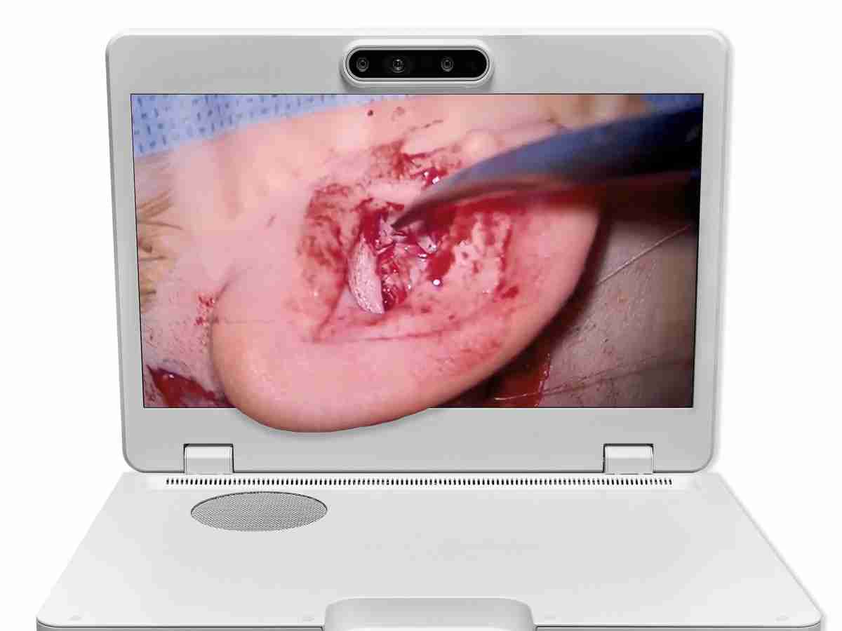 达擎之＂Heads-up 3D显微手术显示系统＂，，整合4K裸眼3D显示及眼球追踪系统，，，具备快速追踪人眼移动位置功能，，减轻医师长时间维持固定姿势的负担，，，让医师能有更宽广清晰的3D立体视野及更舒适的姿势来执行手术。。